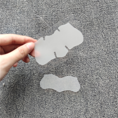 Fjernelse af næsestrimler Hudorme